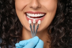 What Is a Tooth Crown? Complete Guide for First-Time Patients