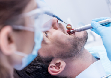 What Is Sinus Lifting for Implants? Procedure, Benefits, and Recovery Explained