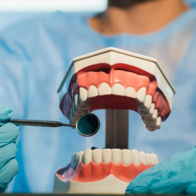 Affordable Veneers: Turkey’s Price Breakdown