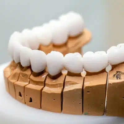 Affordable Options for Dental Veneers Today