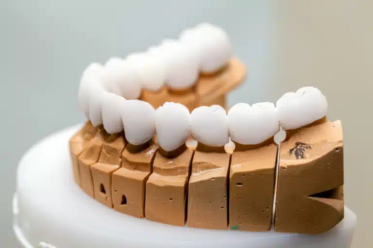 Affordable Options for Dental Veneers Today
